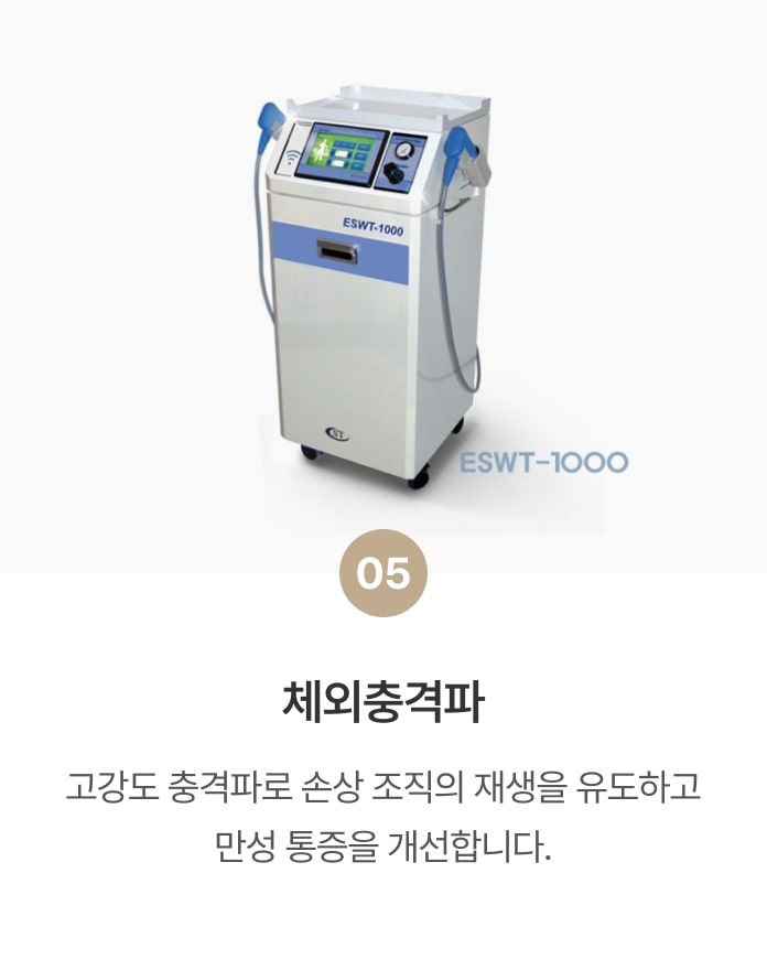 체외충격파