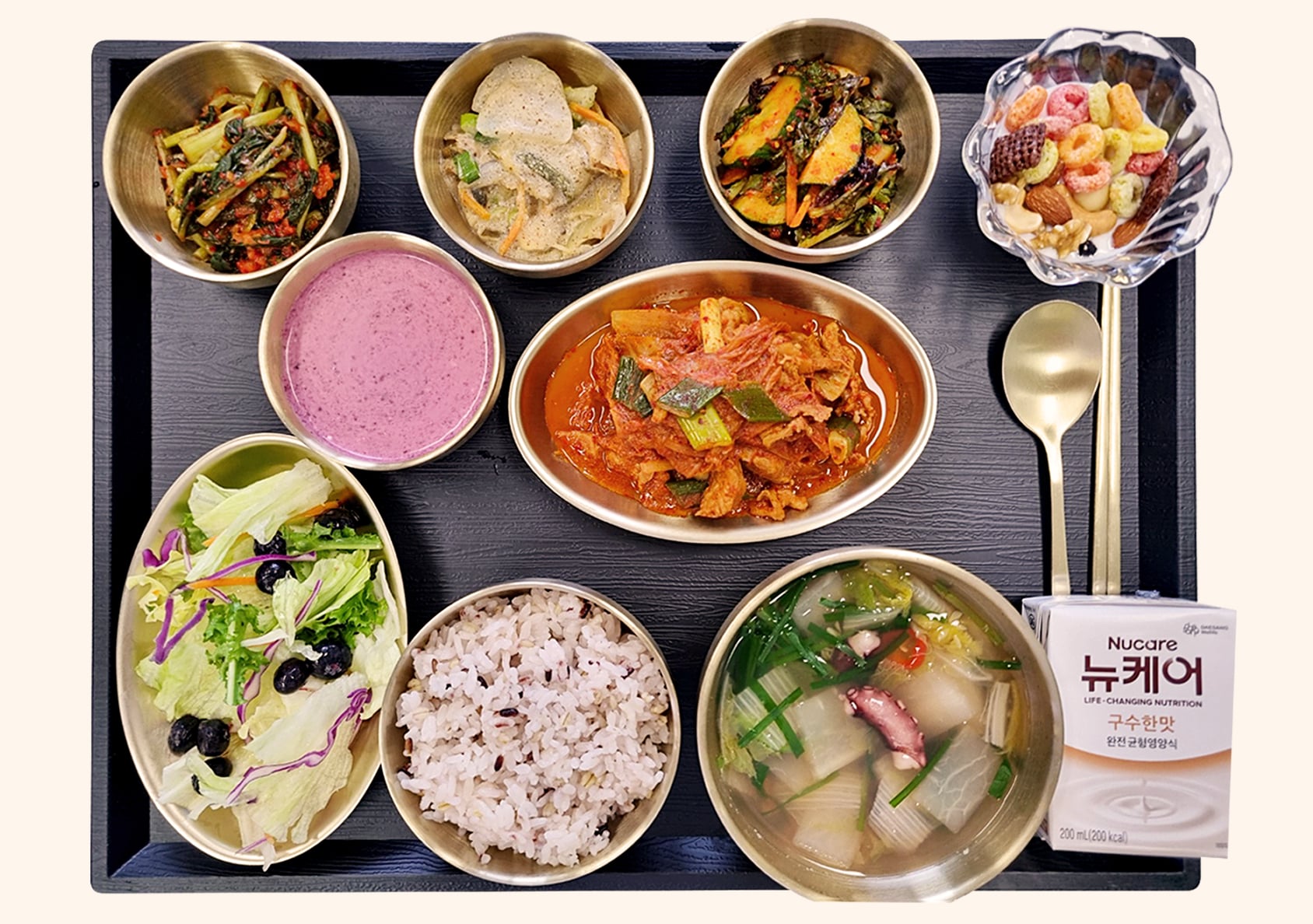 식단 사진
